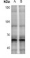 Anti-CHK2 (pT383) Antibody