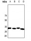 Anti-Calponin 2 Antibody