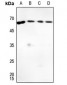 Anti-G-CSF Antibody