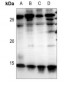 Anti-Cystatin C Antibody