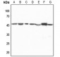 Anti-CTBP1 Antibody