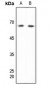 Anti-DDX5 Antibody