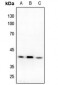 Anti-DFF40 Antibody