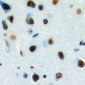 Anti-DLX3 Antibody