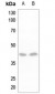 Anti-DLX3 Antibody