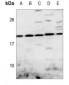 Anti-DUSP22 Antibody