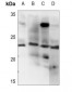 Anti-Endothelin 1 Antibody