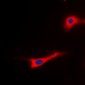 Anti-EEF2 (pT56) Antibody