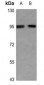 Anti-EEF2 (pT56) Antibody