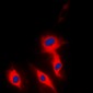 Anti-Ephrin A5 Antibody