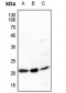 Anti-Ephrin A5 Antibody
