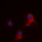 Anti-EIF3L Antibody