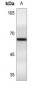 Anti-Estrogen Receptor alpha (pS106) Antibody