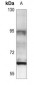 Anti-Estrogen Receptor beta Antibody