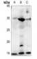 Anti-FABP4 Antibody