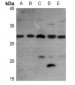 Anti-FGF23 Antibody