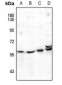 Anti-FOXD3 Antibody