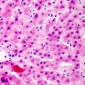 Anti-FRS2 (pY436) Antibody