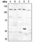 Anti-GAB1 (pY627) Antibody