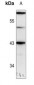 Anti-GATA1 (pS310) Antibody