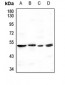Anti-GBA3 Antibody