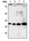 Anti-GCLM Antibody