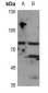 Anti-GIT2 Antibody