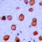 Anti-GLUR2 (pS880) Antibody