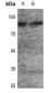 Anti-GLUR2 (pS880) Antibody