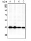 Anti-GSK3 beta Antibody