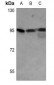 Anti-GYS1 (pS645) Antibody