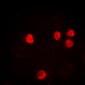 Anti-Histone H2B (AcK12) Antibody