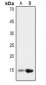 Anti-Histone H2B (AcK12) Antibody