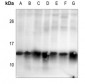 Anti-Histone H2B (AcK15) Antibody