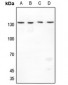 Anti-Histone Deacetylase 4 Antibody
