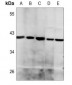 Anti-Histone Deacetylase 8 Antibody
