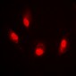 Anti-Histone H4 (AcK8) Antibody