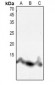 Anti-Histone H4 (AcK8) Antibody