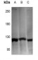 Anti-Hexokinase 1 Antibody