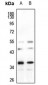 Anti-hnRNP A2/B1 Antibody