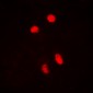 Anti-HSF1 (pS303) Antibody