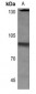 Anti-HSF1 (pS303) Antibody