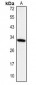 Anti-IGFBP3 Antibody