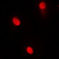 Anti-AIOLOS Antibody