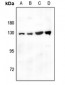 Anti-CD124 Antibody