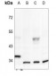 Anti-Inhibin alpha Antibody