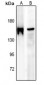 Anti-IRS1 (pS636) Antibody