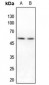 Anti-IRX3 Antibody