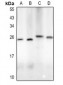 Anti-LIF Antibody