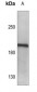 Anti-LMO7 Antibody